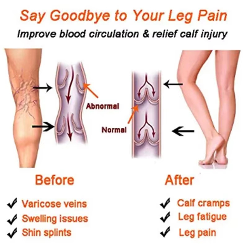 ถุงเท้ารัดกล้ามเนื้อสำหรับผู้ห - Compression Sock Medical บทวิจารณ์และราคา